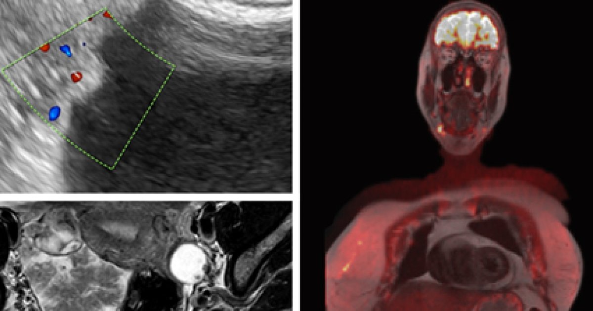 Advanced Course: Gynecological Ultrasound (5th Edition)