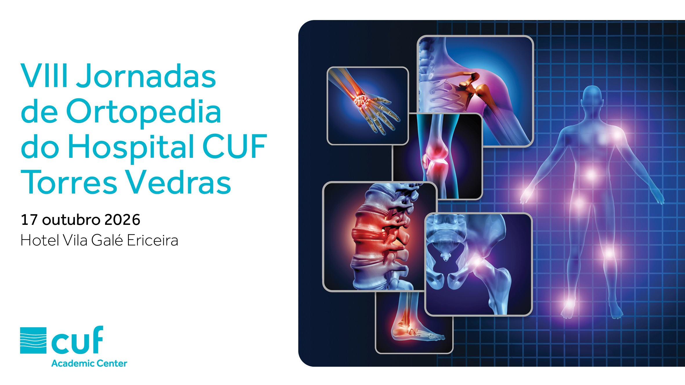 VIII Jornadas de Ortopedia do Hospital CUF Torres Vedras