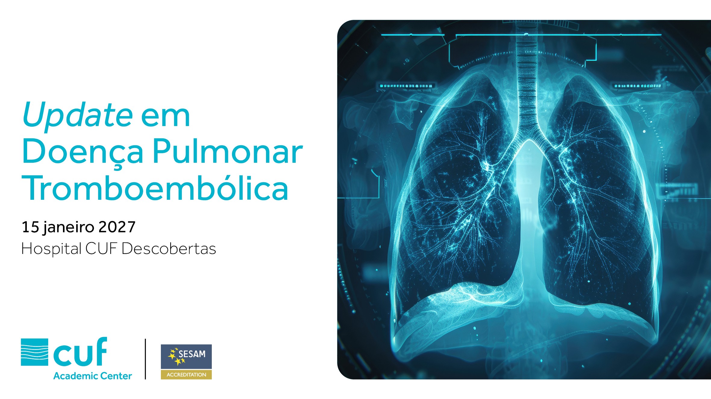 Update em Doença Pulmonar Tromboembólica